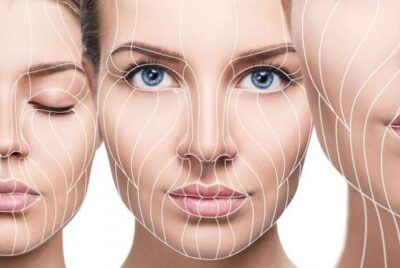 What is a Deep Plane Facelift